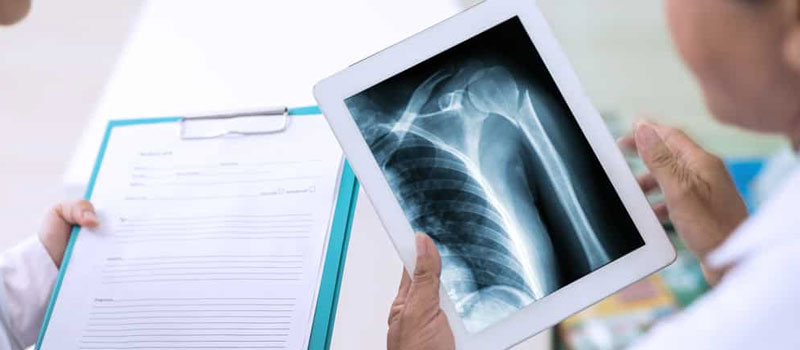 Reliable Trauma X-Ray at Home in Mumbai